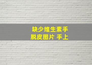 缺少维生素手脱皮图片 手上